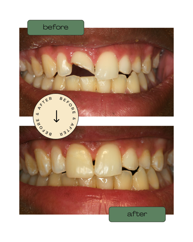 Rescuing a Smile — Dr. Ionescu compassionate dentistry blog article featured image