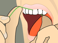 Dentistry by Design dental animated illustration 048 — original 200x150px