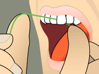 Dentistry by Design dental animated illustration 049 — original 200x150px