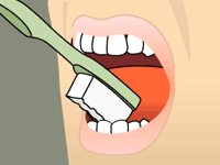 Dentistry by Design dental animated illustration 052 — original 200x150px